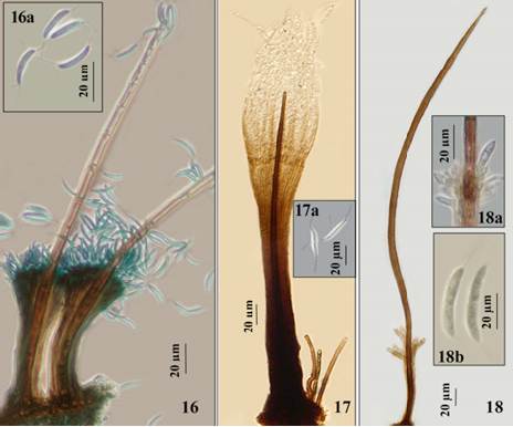 Menisporopsis anisospora. Synnema. 16a. Conidia fusiform with setules. 17. Menisporopsis multisetulata. Synnema. 17a. Conidia fusiform, with setules. 18. Menisporopsis profusa. Synnema. 18a. Conidiogenous cells. 18b. Conidia fusiform, with single setules at each end.