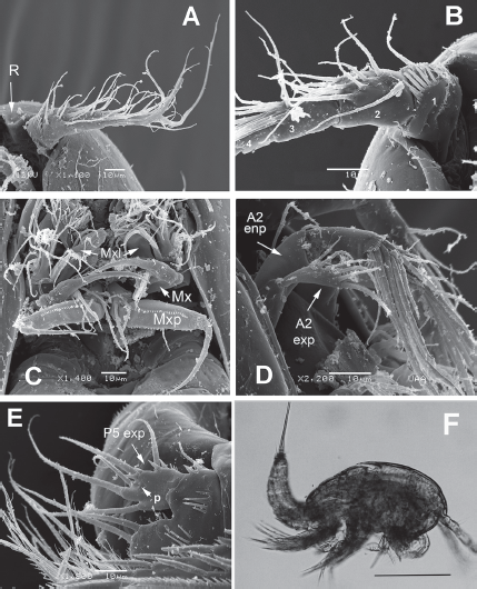 Diarthrodes bodini sp. nov. from Colombia. SEM-prepared female: A, left antennule, ventral view; B, same, showing armature of proximal segments; C, mouthparts, ventral view showing maxillules (Mxl), maxillae (Mx), and maxillipeds (Mxp); D, antenna showing exopod and endopod; E, fifth leg, ventral view; F, male specimen, habitus, lateral view. Scale bar: F = 100 μm.