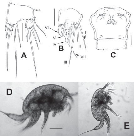Diarthrodes gomezi sp. nov. from Colombia, adult female holotype: A, fifth leg, medial protuberance arrowed; B, caudal ramus, ventral, showing caudal setae I-VII; C, genital double and postgenital somites, ventral view; D, habitus, lateral view; E, adult male allotype, lateral view. Scale bars: A-C = 20 μm, D, E = 100 μm.