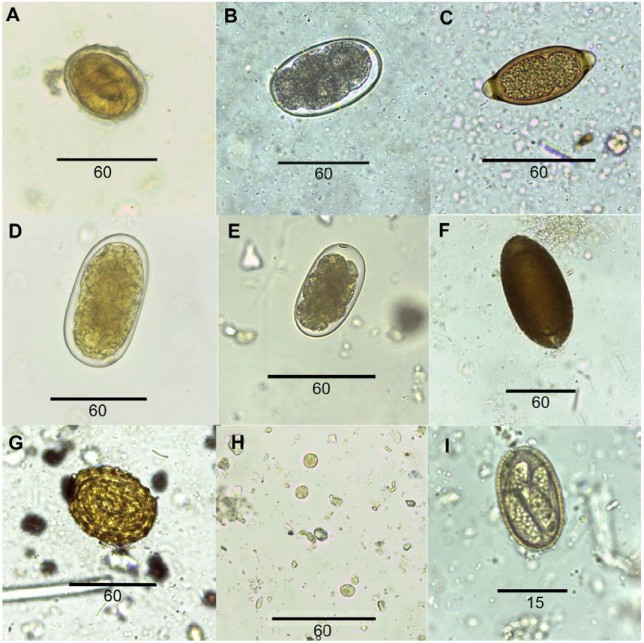 Huevos y quistes de par&aacute;sitos hallados en el an&aacute;lisis coprol&oacute;gico de cerdos asilvestrados en la Bah&iacute;a Samboromb&oacute;n: A, Metastrongylus sp.; B, Oesophagostomum dentatum; C, Trichuris sp.; D, Hyostrongylus sp.; E, Globocephalus sp.; F, Macracanthorhynchus hirudinaceus.; G, Ascaris suum.; H, Iodamoeba sp.; I, Eimeria sp