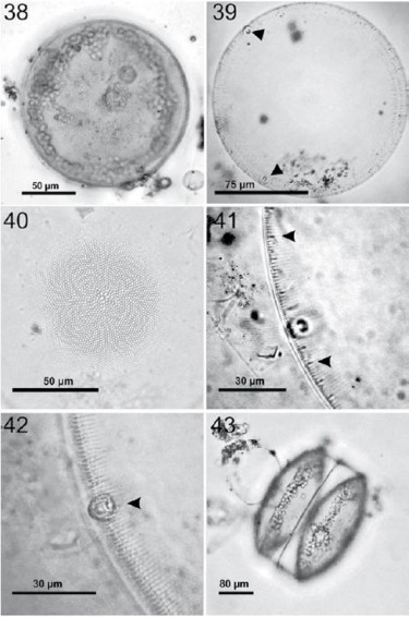 Coscinodiscopsis jonesiana. 38, Preparaci&oacute;n en fresco, fr&uacute;stula completa donde puede observar los cloroplastos en la periferia; 39, fr&uacute;stula completa en preparaci&oacute;n permanente donde se muestra el patr&oacute;n areolar del margen y las 2 grandes macrorimop&oacute;rtulas en la periferia (flechas); 40, misma fr&uacute;stula con el centro en foco donde se muestra el patr&oacute;n areolar de la zona central y la roseta central; 41, rimop&oacute;rtulas marginales (flechas) y una macrorimop&oacute;rtula en el margen de la c&eacute;lula; 42, macrorimop&oacute;rtula en foco (flecha); 43, vista cingular con perfil convexo, en preparaci&oacute;n en fresco