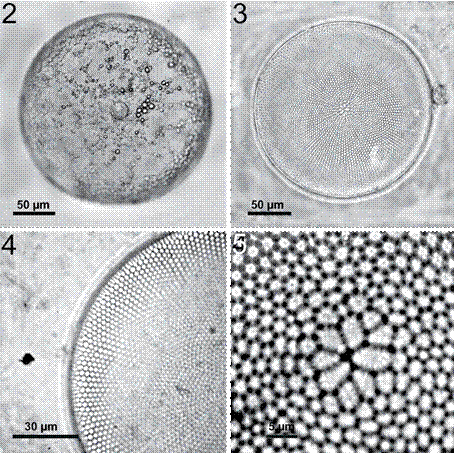 Coscinodiscus asteromphalus. 2, Preparaci&oacute;n en fresco, mostrando la disposici&oacute;n de los cloroplastos concentrados en la zona marginal; 3, preparaci&oacute;n permanente, valva limpia, mostrando el detalle de la roseta central y el patr&oacute;n radial areolar; 4, detalle de la zona media y marginal de la valva mostrando el patr&oacute;n areolar radial; 5, detalle de la roseta central conformada por 10 areolas