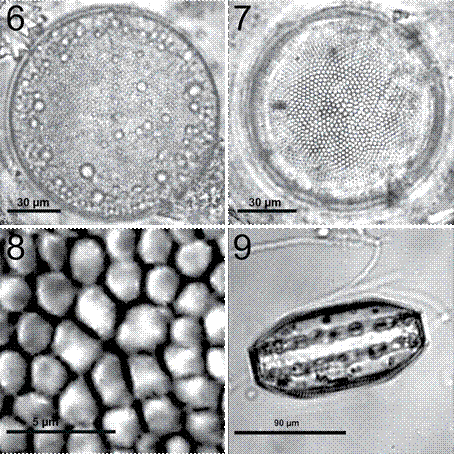 Coscinodiscus centralis. 6, C&eacute;lula completa en preparaci&oacute;n en fresco; 7, preparaci&oacute;n permanente, fr&uacute;stula limpia mostrando el patr&oacute;n areolar radial y la roseta central; 8, detalle de la roseta central con 6 areolas ligeramente m&aacute;s grandes; 9, vista cingular mostrando la altura del manto, en preparaci&oacute;n en fresco