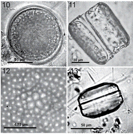 Coscinodiscus concinnus. 10, C&eacute;lula completa en una preparaci&oacute;n en fresco mostrando el patr&oacute;n areolar radial; 11, vista cingular con manto redondeado; 12, preparaci&oacute;n permanente, detalle de la roseta central; 13, vista cingular con manto m&aacute;s pronunciado en preparaci&oacute;n en fresco