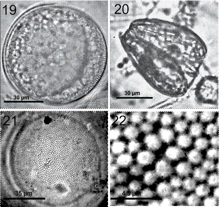 Coscinodiscus granii. 19, C&eacute;lula completa en una preparaci&oacute;n en fresco, mostrando los cloroplastos grandes; 20, vista cingular asim&eacute;trica (forma de cu&ntilde;a); 21, preparaci&oacute;n permanente, fr&uacute;stula limpia mostrando roseta central y patr&oacute;n areolar radial; 22, detalle de las areolas de la parte media de la valva