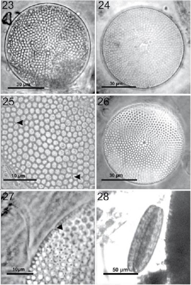 Coscinodiscus perforatus. 23, C&eacute;lula en preparaci&oacute;n en fresco; 24, preparaci&oacute;n permanente, fr&uacute;stula limpia mostrando zona hialina central; 25, secci&oacute;n de la valva abarcando desde el centro al margen con microrimop&oacute;rtulas en la superficie valvar (flechas); 26, detalle de roseta central con 7 areola distintivas y una peque&ntilde;a zona hialina en el centro; 27, margen con una macrorimop&oacute;rtula (flecha); 28, vista cingular muy estrecha, en preparaci&oacute;n en fresco