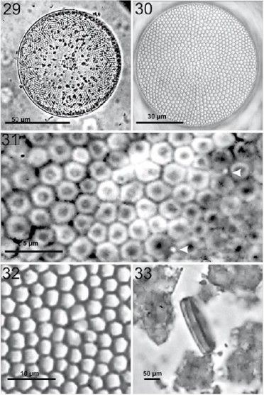 Coscinodiscus radiatus. 29, Vista de la fr&uacute;stula completa en preparaci&oacute;n en fresco donde se pueden observar los cloroplastos dispersos por toda la c&eacute;lula; 30, vista valvar en preparaci&oacute;n permanente, mostrando el patr&oacute;n areolar y a roseta central formada por 9 areolas; 31, aumento de las areolas en la zona marginal donde se aprecian rimop&oacute;rtulas sobre la valva (flechas); 32, vista de la roseta central con 4 areolas ligermante m&aacute;s grandes que el resto; 33, vista cingular muy estrecha, en preparaci&oacute;n en fresco
