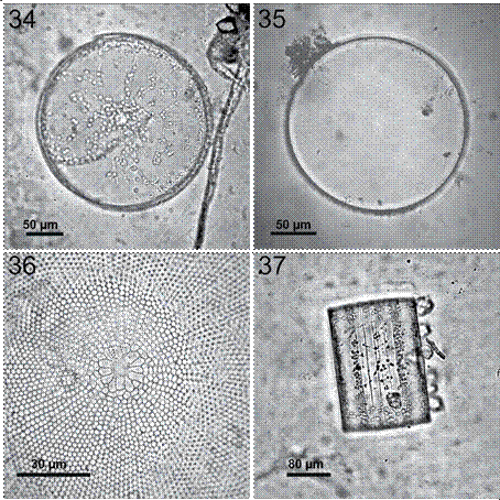 Coscinodiscus wailesii. 34, Vista de la fr&uacute;stula completa en una preparaci&oacute;n en fresco donde se observan los cloroplastos distribuidos en toda la c&eacute;lula, es posible ver toda la c&eacute;lula en foco; 35, vista valvar en preparaci&oacute;n permanente, se observan areolas peque&ntilde;as distribuidas en un patr&oacute;n radial sectorizado y una roseta central con un &aacute;rea central hialina evidente; 36, roseta central con 14 areolas m&aacute;s grandes y un centro hialino circular; 37, vista cingular con forma de tambor, en preparaci&oacute;n en fresco, con organismos ep&iacute;fitos en la superficie valvar de la fr&uacute;stula