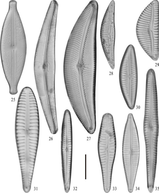 25) Anomoeoneis sphaerophora; 26) Cymbella mexicana; 27) Cymbella aspera; 28) Encyonema mesianum; 29) Encyonema silesiacum; 30) Navicymbula pusilla; 31) Gomphonema affine; 32) Gomphonema angustatum; 33) Gomphonema clavatum; 34) Gomphonema gracile; 35) Gomphonema hebridense. Barra = 10 μm; 26 y 27) = 25 μm