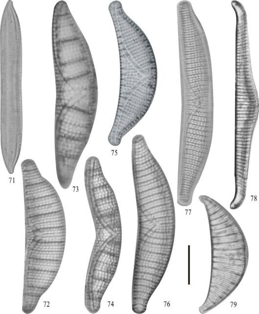 71) Tryblionella apiculata; 72) Epithemia adnata; 73) Epithemia argus; 74) Epithemia argus var. alpestris; 75) Epithemia sorex; 76) Epithemia turgida; 77) Epithemia turgida var. granulata; 78) Rhopalodia gibba; 79) Rhopalodia operculata. Barra = 10 μm