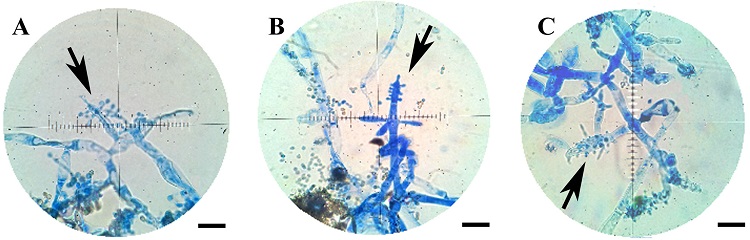 Im&aacute;genes fotogr&aacute;ficas microsc&oacute;picas correspondientes a las cepas f&uacute;ngicas. A) HEP 25; B) HEP15; C) HEP18. Barra 20 &micro;m. Las flechas indican los conidi&oacute;foros. Tinci&oacute;n con lactofenol adicionado con azul de algod&oacute;n.