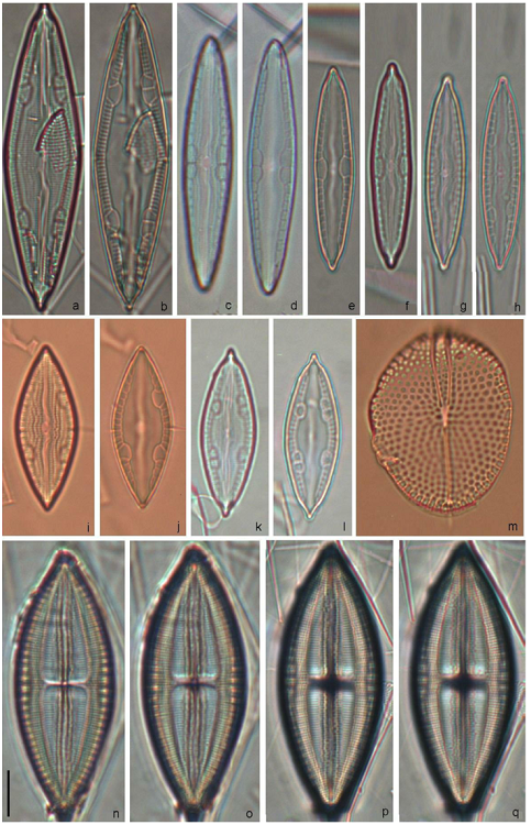 Mastogloia erythraea (a, b, k, l), M. biocellata (c-f), M. erythraea f. 1 (g, h), M. erythraea f. 2 (i, j), M. cribrosa (m), M. foliolum (n-q). Scale bar = 10 &micro;m for all specimens.