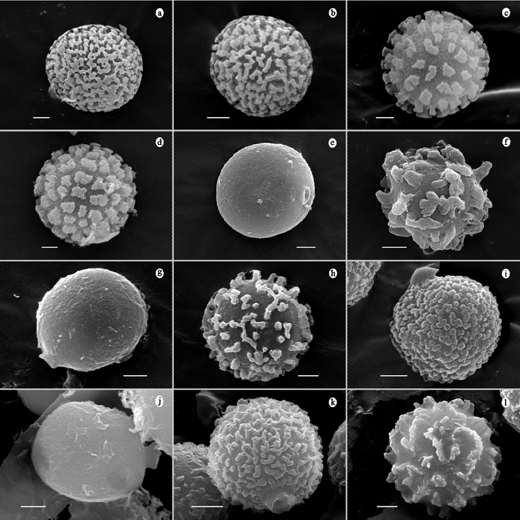 Sporal ornamentation by SEM. a, Battarrea phalloides
							(UES 4861); b, Battarreoides diguetii (UES 10479); c,
								Chlamydopus meyenianus (UES 4400); d,
								Phellorinia herculeana (UES 10063); e,
								Schizostoma laceratum (UES 2815); f,
								Tulostoma albicans (UES 10067); g, T.
								cretaceum (UES 10314); h, T. fimbriatum
							(UES 10093); i, T. gracilipes (UES 9100); j, T.
								leiosporum (UES 8241); k, T. longii (UES
							10116); l, T. macrosporum (UES 10112). Scale bar = 1
							μm.
