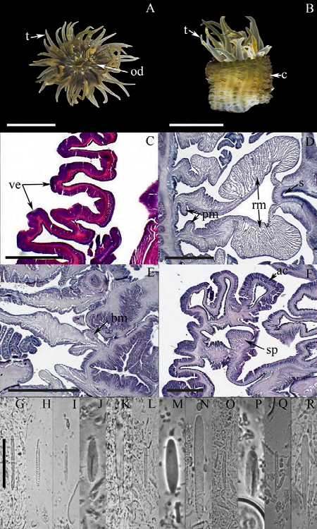 Anthopleura dalyae. A) Oral view, tentacles fully
							expanded; B) lateral view; C) longitudinal section through column,
							detail of verrucae; D) cross section through column, detail of a
							siphonoglyph, retractor and parietobasilar muscles; E) longitudinal
							section through proximal column, detail of basilar muscles; F)
							longitudinal section through distal column, detail of the marginal
							sphincter muscle. Cnidom: tentacles: G) basitrich, H) spirocyst;
							actinopharynx: I) small basitrich, J) microbasic
							p-mastigophore, K) microbasic
							b-mastigophore; column: L) basitrich, M) holotrich;
							Acrorhagi: N) holotrich, O) basitrich; filaments: P) microbasic
								p-mastigophore, Q) basitrich, R) microbasic
								b-mastigophore. Abbreviations, ac: acrorhagi, bm:
							basilar muscles, c: column, od: oral disc, pm: parietobasilar muscles,
							rm: retractor muscles, s: siphonoglyph, sp: sphincter, t: tentacles, ve:
							verrucae. Scale bars, A, B: 10 mm; C-F: 200 μm; G-R: 10 μm.