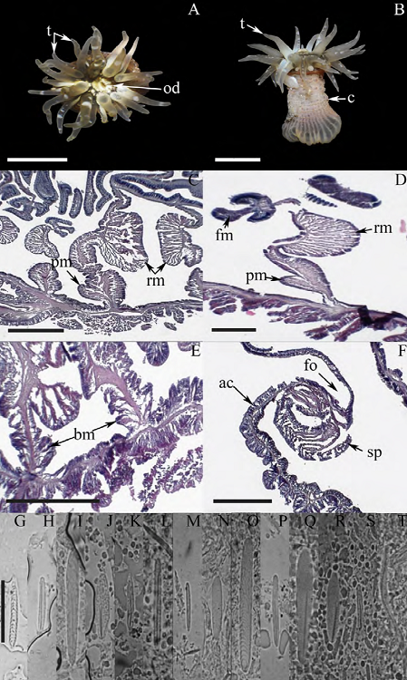 Anthopleura krebsi. A) Oral view, tentacles fully
							expanded; B) lateral view; C) cross section through column, detail of a
							mesentery and retractor muscles; D) cross section through column, detail
							of a mesentery, retractor and parietobasilar muscles; E) longitudinal
							section through proximal column, detail of basilar muscles; F)
							longitudinal section through distal column, detail of the marginal
							sphincter muscle and acrorhagi. Cnidom: tentacles: G) spirocyst, H)
							basitrich; actinopharynx: I) microbasic b-mastigophore,
							J) microbasic p-mastigophore, K) small basitrich, L)
							basitrich; column: M) basitrich, N) holotrich; acrorhagi: O) holotrich,
							P) basitrich; filaments: Q) microbasic b-mastigophore,
							R) microbasic p-mastigophore, S) small basitrich, T)
							long curve basitrich. Abbreviations, ac: acrorhagi, bm: basilar muscles,
							c: column, fm: filaments, fo: fosse, od: oral disc, pm: parietobasilar
							muscles, rm: retractor muscles, sp: sphincter, t: tentacles. Scale bars,
							A, B: 10 mm; C-F: 200 μm; G-T: 10 μm.