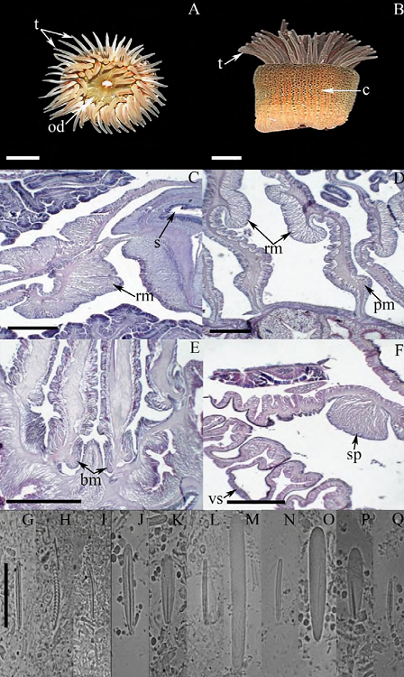 Bunodosoma cavernatum. A) Oral view, tentacles fully
							expanded; B) lateral view; C) cross section through column, detail of a
							siphonoglyph and retractor muscles; D) cross section through column,
							detail of retractor and parietobasilar muscles; E) longitudinal section
							through proximal column, detail of basilar muscles; F) longitudinal
							section through distal column, detail of the marginal sphincter muscle
							and vesicles. Cnidom: tentacles: G) basitrich, H) spirocyst;
							actinopharynx: I) small basitrich, J) basitrich, K) microbasic
								p-mastigophore; column: L) basitrich; acrorhagi: M)
							holotrich, N) basitrich; filaments: O) microbasic
							b-mastigophore, P) microbasic
							p-mastigophore, Q) basitrich. Abbreviations: bm:
							basilar muscles, c: column, od: oral disc, rm: retractor muscles, pm:
							parietobasilar muscles, s: siphonoglyph, sp: sphincter, t: tentacles,
							vs: vesicles. Scale bars: A, B: 10 mm; C-F: 200 μm; G-Q: 10 μm.