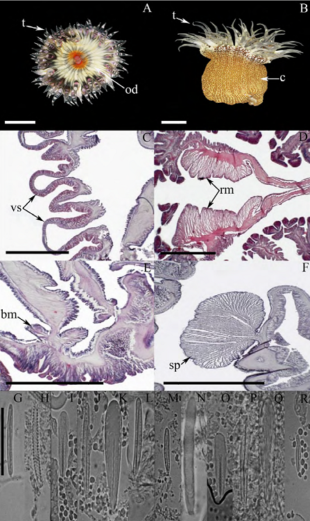Bunodosoma granuliferum. A) Oral view, tentacles
							fully expanded; B) lateral view; C) longitudinal section through column,
							detail of vesicles; D) cross section through column, detail of a pair of
							mesenteries and retractor muscles; E) longitudinal section through
							proximal column, detail of basilar muscles; F) longitudinal section
							through distal column, detail of the marginal sphincter muscle. Cnidom:
							tentacles: G) basitrich, H) spirocyst; actinopharynx: I) microbasic
								p-mastigophore, J) basitrich, K) microbasic
								b-mastigophore; column: L) basitrich; acrorhagi: M)
							basitrich, N) holotrich; filaments: O) microbasic
							p-mastigophore, P) basitrich, Q) microbasic
								b-mastigophore, R) small basitrich. Abbreviations:
							bm: basilar muscles, c: column, od: oral disc, rm: retractor muscles,
							sp: sphincter, t: tentacles, vs: vesicles. Scale bars: A, B: 10 mm; C-F:
							200 μm; G-R: 10 μm.