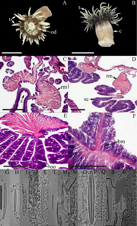Exaiptasia diaphana. A) Oral view, tentacles fully
							expanded; B) lateral view; C) longitudinal section through column,
							detail of a siphonoglyph and retractor muscles; D) cross section through
							column, detail of retractor muscles and spermatic cysts; E) cross
							section through column, detail of oocysts; F) longitudinal section
							through proximal column, detail of basilar muscles. Cnidom: tentacles:
							G) microbasic p-amastigophore, H) basitrich, I)
							spirocyst; actinopharynx: J) basitrich, K) microbasic
							p-amastigophore; column: L) basitrich, M) microbasic
								p-amastigophore, N) microbasic
							b-mastigophore; acontia: O) small microbasic
								p-amastigophore, P) microbasic
							p-amastigophore, Q) basitrich; filaments: R) microbasic
								p-amastigophore, S) small basitrich, T) basitrich.
							Abbreviations: a: acontia, bm: basilar muscles, c: column, od: oral
							disc, oo: oocysts, rm: retractor muscles, s: siphonoglyph, sc: spermatic
							cysts, t: tentacles. Scale bars, A, B: 10 mm; C-F: 200 μm; G-T: 10
							μm.