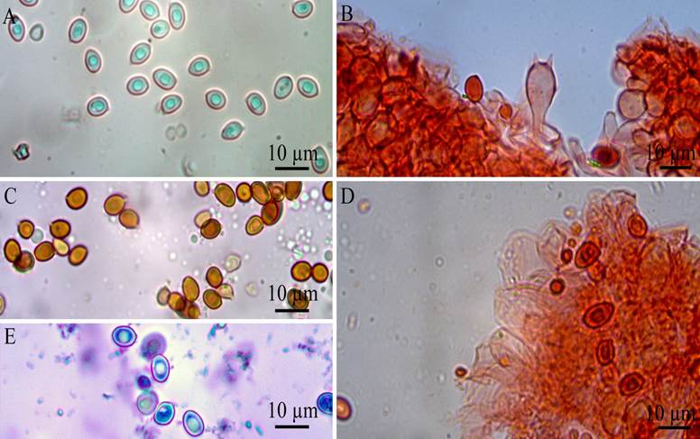 Leucocoprinus rhodolepis (holotype): A, Basidiospores in 3% KOH; B, basidiospores and 1 basidium in Congo red; C, basidiospores in Melzer&rsquo;s reagent; D, cheilocystidia in Congo red; E, basidiospores in Cresyl blue.
