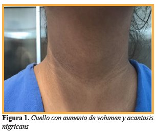Cuello con aumento de volumen y acantosis nigricans