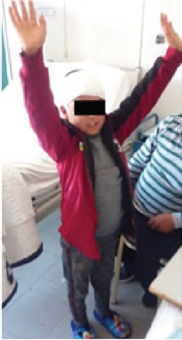 Paciente el d�a de alta Nota Paciente con evoluci�n favorable hasta ser dado de alta el s�ptimo d�a postoperatorio