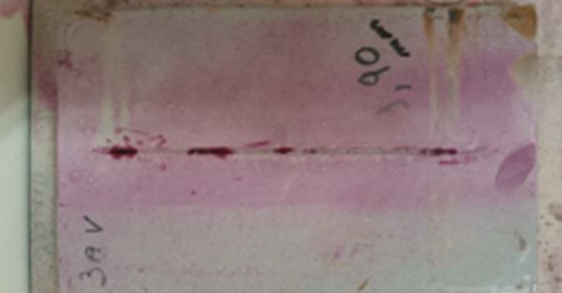 Specimen awaiting development