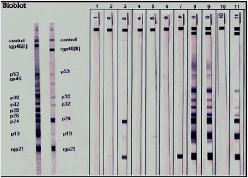Patrones de bandas observadas en la prueba de Western Blot para el HTLV-1/2