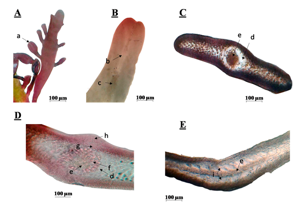 A.
Rama cistocárpica. B. Vista superficial de pínula que muestra márgenes estériles
alrededor del cistocarpo alargado. C-D. Corte transversal de un cistocarpo maduro
que muestra un lóculo y un ostiolo. E. Corte longitudinal de una pínula fértil
que muestra carpogonios intercalares en ambos lados de un eje con filamentos
nutritivos. a. pínula fértil. b. márgenes estériles. c. cistocarpo. d. lóculo.
e. células nutritivas. f. carposporas. g. filamentos corticales internos. h.
ostiolo. i. carposporangio.