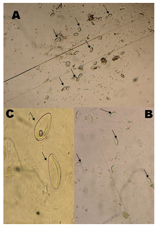 Huevos de Enterobius vermicularis sobre la superficie de
cinta adhesiva. A: 50X; B: 100X; C: 400X.