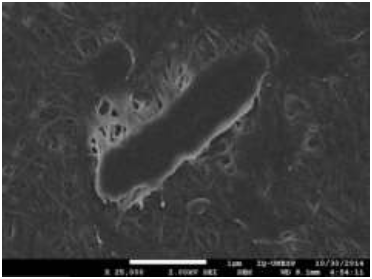 Microscopia Eletr&ocirc;nica de Varredura da G. hansenii e a ultraestrutura da CB secretada pelo micro- organismo.