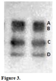 Zymogram of endoxylanases present from crude enzymatic extract produced by the fungus R. emersonii. The gel was stained with 0.1% congo red and detained with 1 mol L&ndash;1 NaCl. The dark bands show the presence of xylanase and the letters (A, B, C and D) identify the possible isoforms of the enzyme (the image was transformed from color to shades of gray, then into its negative and the contrast became more evident using the free software GIMP version 2.8.10 for Linux).