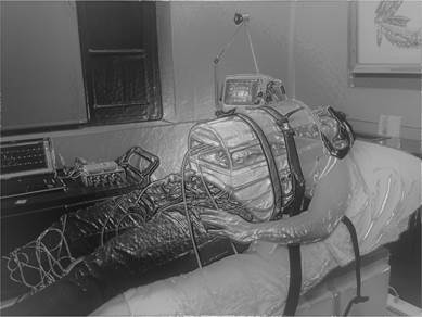Photograph of the designed device superimposed over the chest and abdomen of a healthy subject under noninvasive mechanical ventilation
