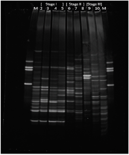 Photograph obtained from DGGE for the biomass of the SBR system at the different stages of operation