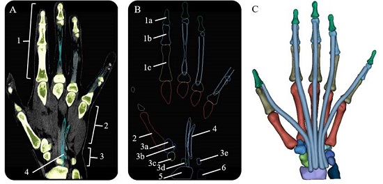 Coronal scan, mask contours, and 3D model reconstruction on the right hand: (A) Both bone (green) and sheath (cyan) masks; (1) Phalanxes (2) Metacarpus (3) Carpus (4) Tendinous sheaths (B) Contours of segmented structures; (1a) Distal Phalanx (1b) Middle Phalanx (1c) Proximal Phalanx (2) Metacarpal (3a) Trapezium (3b) Trapezoid (3c) Scaphoid (3d) Lunate (3e) Pisiform (4) Tendinous sheaths (5) Radius (6) Ulna (C) 3D Model reconstruction