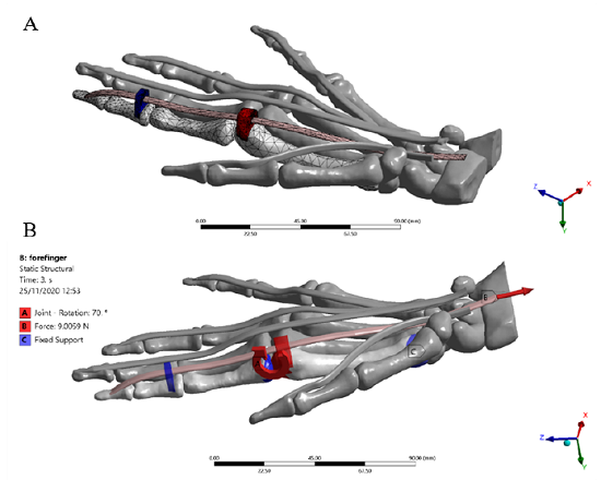 View of the index finger 3D model used in Finite element simulation, Ansys Static structural environment. (A) Mesh of the index finger model, tetrahedral formulation TED10 (B) Boundary conditions applied to the model