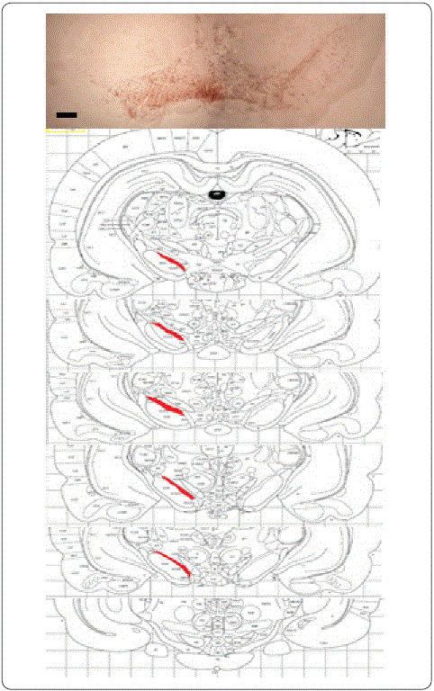 Lesi&oacute;n con 6-OHDA en el hemisferio izquierdo. A.Microfotograf&iacute;a
							representativa de inmunodetecci&oacute;n de TH en un corte coronal de cerebro
							de rata con 6-OHDA, a nivel de la sustancia negra pars
								compacta (SNc) (barra = 100 mm). B.Secciones
							representativas del atlas correspondiente a la zona de la SNc donde se
							realizaron los conteos neuronales. Elaboraci&oacute;n personal.
