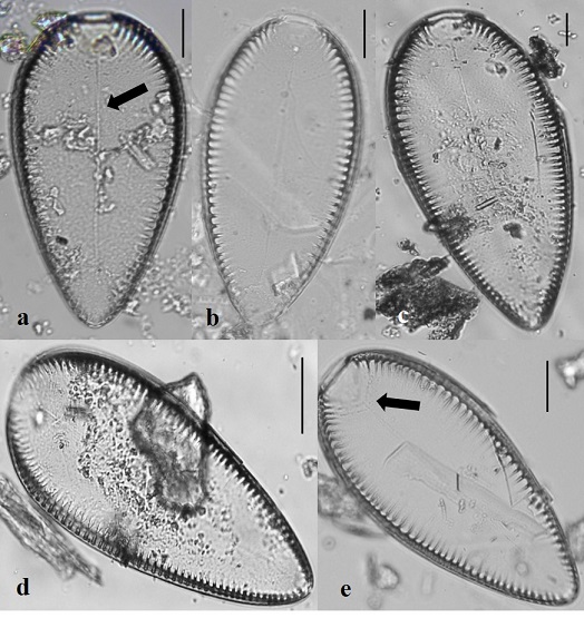 Iconella guatimalensis. Microscopio de luz (100x). Escala de la barra 20 μm. a-e. Vista valvar. a. La flecha indica la línea axial. e. La flecha indica la región cóncava en el polo anterior con la terminación proximal del rafe.