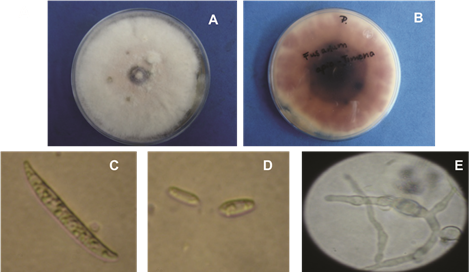 Crecimiento de las colonias (A y B) y caracter&iacute;sticas morfol&oacute;gicas de los macro (C), microconidios (D) y clamid&oacute;sporas (E) del hongo Fusarium oxysporum f. sp. apii aislados de plantas de apio.