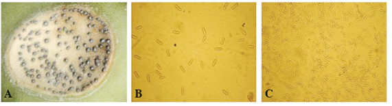 Organismos saprófitos presentes en lesiones viejas provocadas por E. hormaechei, bajo condiciones de época seca. A. Acérvulos de Colletotrichum spp. B. Conidios de Colletotrichum spp. C. Conidios de Fusarium spp.