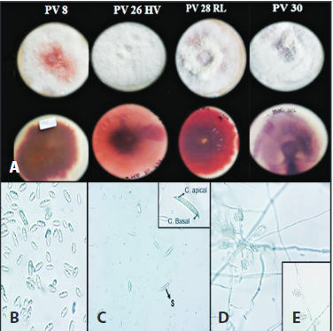 Caracter&iacute;sticas morfol&oacute;gicas de los aislamientos de Fusarium concentricum A) Color de la colonia en PDA B) Microconidios en el micelio a&eacute;reo (en PDA) C) Macroconidios, C. apical; c&eacute;lula apical, C. basal; c&eacute;lula basal, D) Esporodoquio ramificado y E) Conidi&oacute;foros simples y cortos en medio de cultivo CLA (40X).