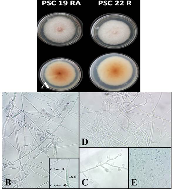 Caracter&iacute;sticas morfol&oacute;gicas de los aislamientos de Fusarium proliferatum A) Color de la colonia (PDA), B) Macroconidios, C. apical; c&eacute;lula apical, C. basal; c&eacute;lula basal, S: septos, C) Conidi&oacute;foros simples y cortos D) Conidi&oacute;foros en falsas cabezas y E) Microconidios en el micelio a&eacute;reo en medio de cultivo CLA (40X).