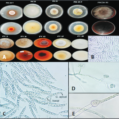 Caracter&iacute;sticas morfol&oacute;gicas de los aislamientos de Fusarium solani A) Color de la colonia en PDA B) Microconidios, C) Macroconidios C. apical; c&eacute;lula apical, C. basal; c&eacute;lula basal, D) Monofi&aacute;lides cortas y E) Clamidospora intercalar en medio de cultivo CLA (40X).
