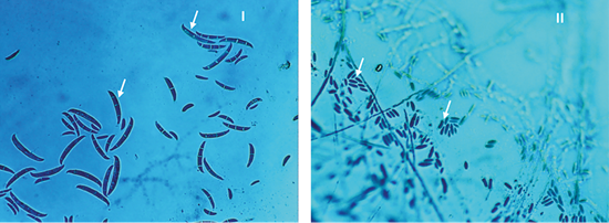 Forma de los macroconidios I (F. oxysporumaislado B) y II (F. phyllophylumaislado G) crecidos en medio CLA, observados a 40x. 