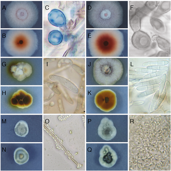 Caracter&iacute;sticas morfol&oacute;gicas de los aislamientos inoculados y recuperados a partir de plantas de fresa (Fragaria ananassa (Weston) Roziersp.) variedad Festival, luego de 19 semanas en invernadero. A, B y C. Aislamiento F2, Fusarium oxysporum s.l., luego de 7 d&iacute;as de crecimiento en PDA. A Colonia anverso. B Colonia reverso. C Clamidosporas. D, E y F. Aislamiento F2_52, Fusarium oxysporum s.l., luego de 7 d&iacute;as de crecimiento en PDA. A Colonia anverso. B Colonia reverso. C Clamidosporas. G, H e I. Aislamiento F33, Neonectria sp. luego de 7 d&iacute;as de crecimiento en PDA. A Colonia anverso. B Colonia reverso. C Macroconidios. J, K y L. Aislamiento F33_50, Dactylonectria sp., luego de 7 d&iacute;as de crecimiento en PDA. A Colonia anverso. B Colonia reverso. C Macroconidios y un microconidio. M, N y O. Aislamiento F238, Sydowia polyspora, luego de 7 d&iacute;as de crecimiento en PDA. A Colonia anverso. B Colonia reverso. C Hifa y conidios. P, Q y R. Aislamiento F238_49, Sydowia polyspora, luego de 7 d&iacute;as de crecimiento en PDA. A Colonia anverso. B Colonia reverso. C Conidios.