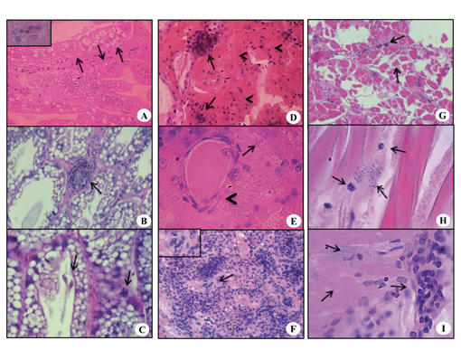 Cortes histológicos de hepatopáncreas, órgano linfoide, músculo en L. vannamei infectados con V. parahaemolyticus. Costa Rica. 2012.