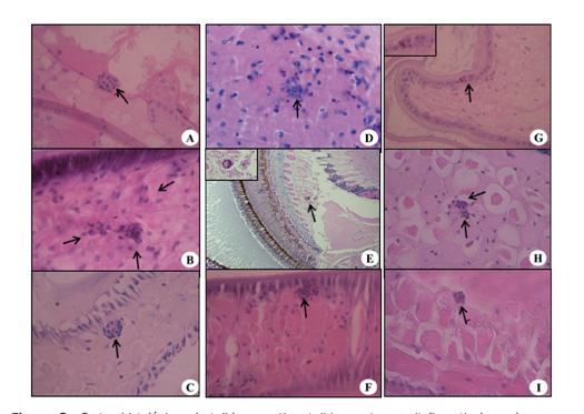 Cortes histológicos de tejido conectivo, tejido nervioso, epitelio cuticular, palpo mandibular en L. vannamei infectados con V. parahaemolyticus. Costa Rica. 2012.
				