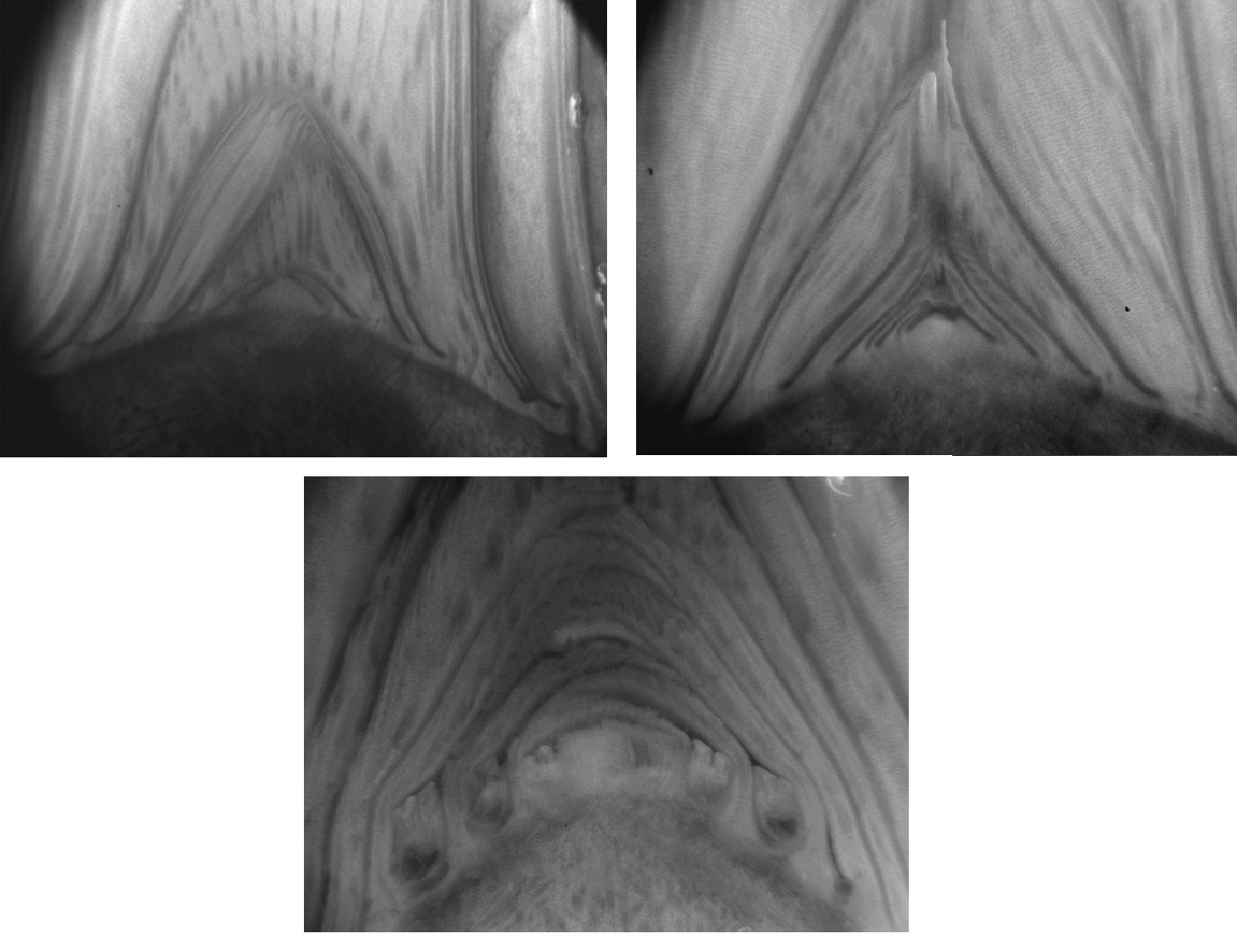 Zona apical de plantas de plátano (Musa AAB) del subgrupo Falso Cuerno: A- meristemo apical vegetativo (1) cubierto por los primordios foliares (2). B- meristemo apical en fase de transición (1) mostrando una posición ascendente. C- meristemo apical reproductivo (1) con primordios de brácteas florales  laterales (2)  y primordios de frutos (3) en las axilas. Estudio II. Pococí, Limón, Costa Rica. 2009- 2010.