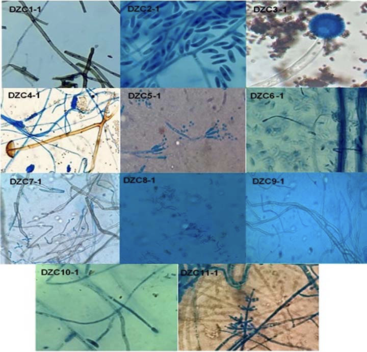 Fotograf�as de la microscop�a (100x) realizada con azul de lactofenol a los once morfotipos de hongos asociados con la pudrici�n seca de los tub�rculos de �ame (Dioscorea rotundata). Zona costanera del departamento de C�rdoba en Colombia. Laboratorio del Centro de Investigaci�n Turipan� de la Corporaci�n Colombiana de Investigaci�n Agropecuaria (AGROSAVIA). Colombia, 2019.