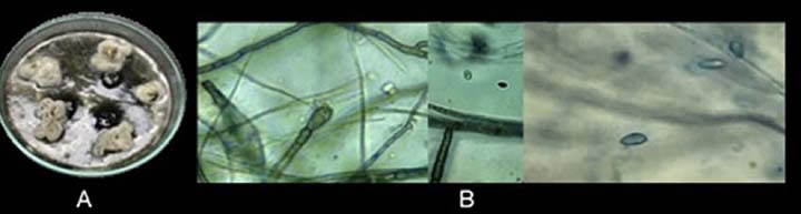 Fotograf�as de las caracter�sticas morfol�gicas del morfotipo DZC1-1 en caldo de ma�z. A) anverso de la colonia a los siete d�as y B) microscop�a realizada con azul de lactofenol. Zona costanera del departamento de C�rdoba en Colombia. Laboratorio del Centro de Investigaci�n Turipan� de la Corporaci�n Colombiana de Investigaci�n Agropecuaria (AGROSAVIA). 2019.