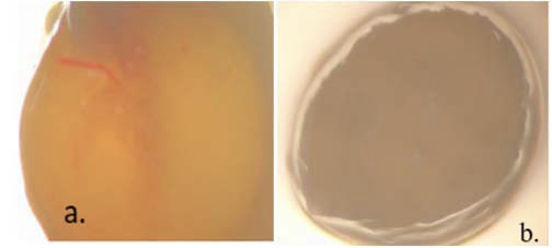 Imagen de evaluaci�n de fol�culos de bovinos (Bos indicus), de buena y deficiente calidad. (a) Fol�culo irrigado y (b) fol�culo sin ning�n nivel de irrigaci�n. Laboratorio de Reproducci�n del centro de Investigaci�n La libertad, Corporaci�n Colombiana de Investigaci�n Agropecuaria (AGROSAVIA), Villavicencio, Meta, Colombia. 2017.